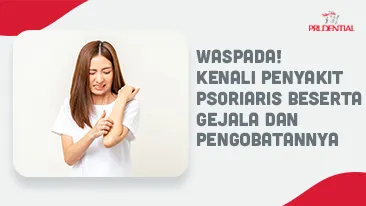 Apa Itu Psoriasis ? Ketahui Penyebab dan Cara Penanganannya